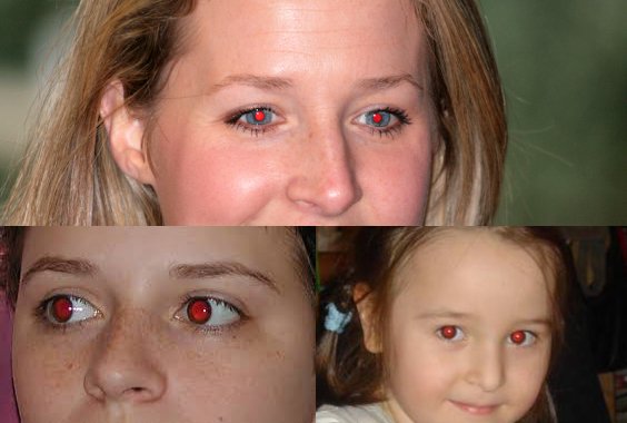 How to Get Rid of Red Eye Effect